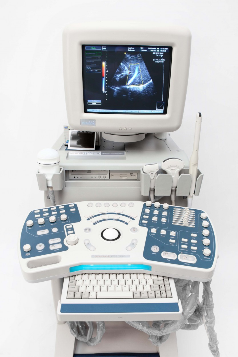 Medison SonoAce 9900 1